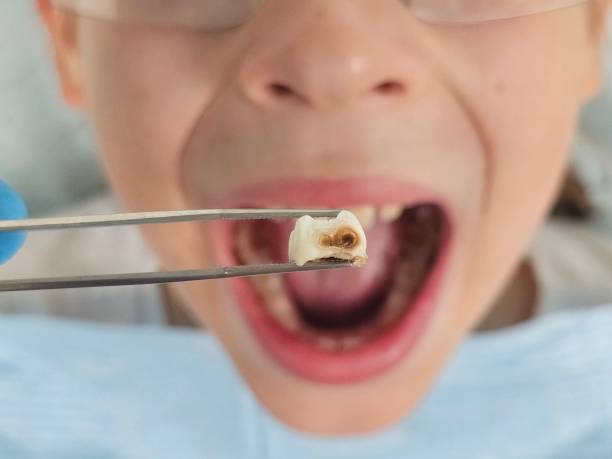 Best Pediatric Emergency Dentist in Callahan, FL